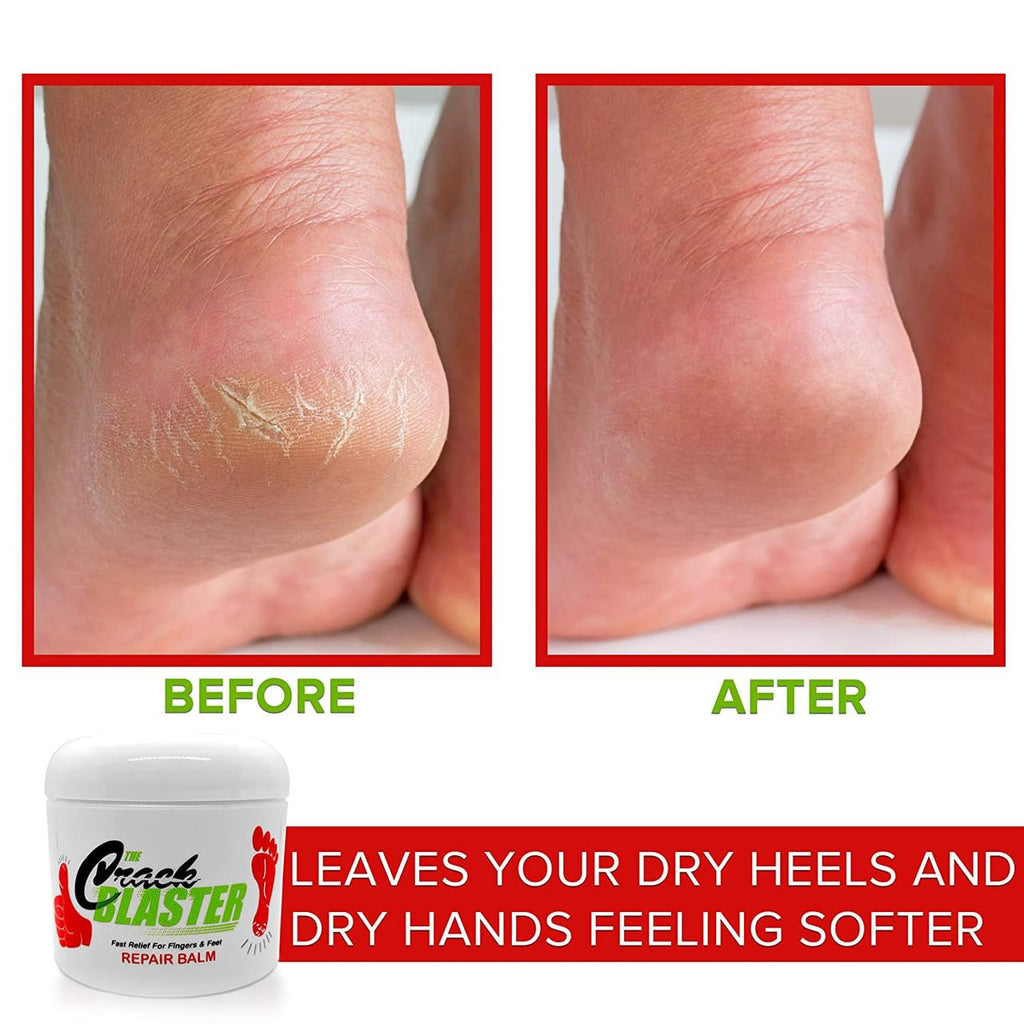 The Crack Blaster Repair Lanolin Balm