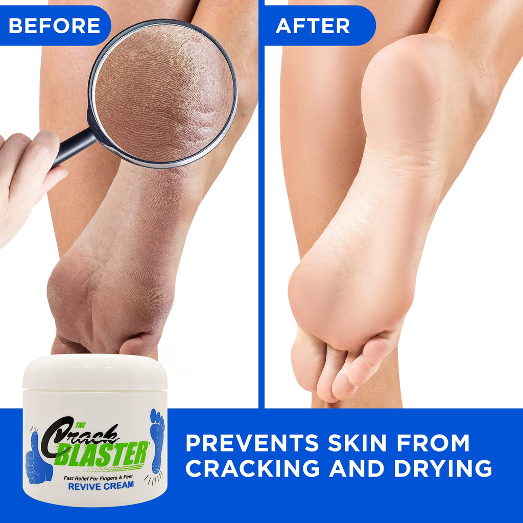 Crack Blaster Revive Cream